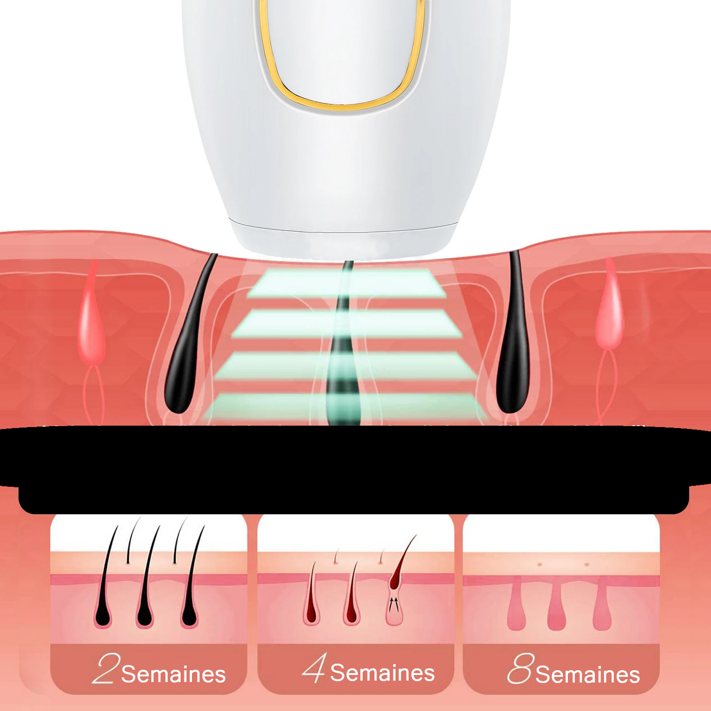 Epilateur Laser